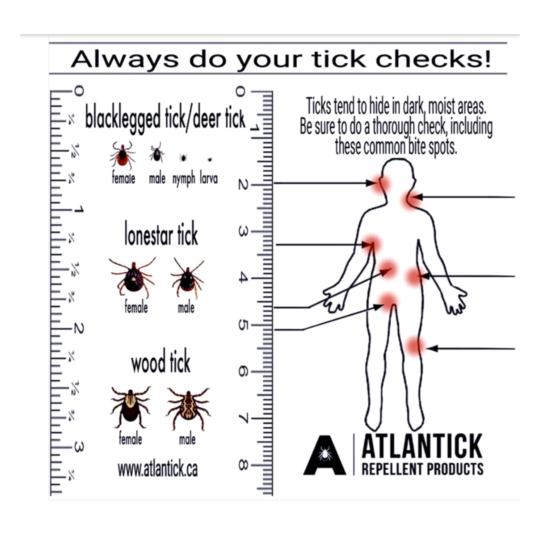 Atlantick - TickKit